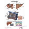 3D Medical Chart ---- Liver